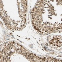 Anti-UBE2Z antibody produced in rabbit 