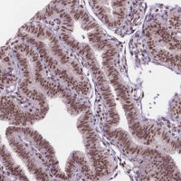 Anti-UBN1 antibody produced in rabbit 