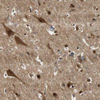 Anti-UBQLN2 antibody produced in rabbit 