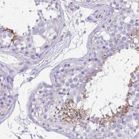 Anti-UBQLN3 antibody produced in rabbit 