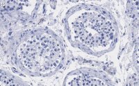 Anti-UBR5 Antibody, clone 2F14 ZooMAb Rabbit Monoclonal 