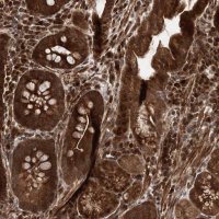 Anti-UBTD2 antibody produced in rabbit HPA035891-100UL