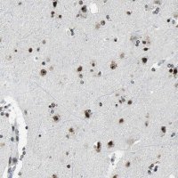 Anti-UBTF antibody produced in rabbit 