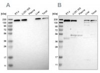 Anti-UGGT1 antibody produced in rabbit HPA015127-100UL