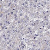 Anti-UHRF1 antibody produced in rabbit 