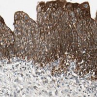 Anti-ULK2 antibody produced in rabbit 