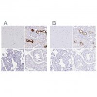 Anti-UMOD antibody produced in rabbit 
