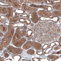 Anti-UMPS antibody produced in rabbit 