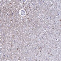 Anti-UNC80 antibody produced in rabbit 