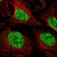 Anti-UNC93B1 antibody produced in rabbit 