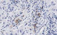 Anti-uPAR Antibody, clone 2G10 , ZooMAb Rabbit Monoclonal 