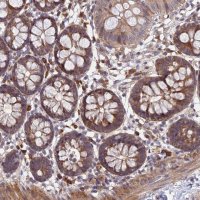 Anti-UROS antibody produced in rabbit 