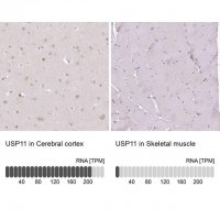 Anti-USP11 antibody produced in rabbit 