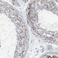 Anti-UTP6 antibody produced in rabbit 