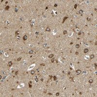 Anti-VAPB antibody produced in rabbit 