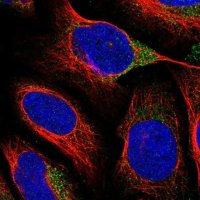Anti-VAT1L antibody produced in rabbit 