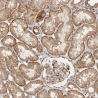 Anti-VEPH1 antibody produced in rabbit 