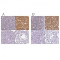 Anti-VGLUT1 antibody produced in rabbit 