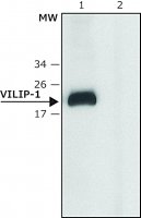 Anti-VILIP-1 (C-terminal) antibody produced in rabbit 