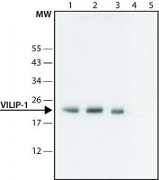 Anti-VILIP-1 (N-terminal) antibody produced in rabbit 