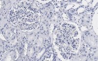 Anti-Vimentin Antibody, clone 2I13 ZooMAb Rabbit Monoclonal 