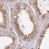 Anti-VPS18 antibody produced in rabbit 
