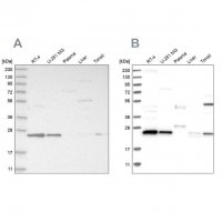 Anti-VPS28 antibody produced in rabbit 