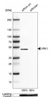 Anti-VRK1 antibody produced in rabbit 