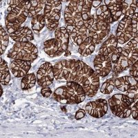 Anti-VSIG1 antibody produced in rabbit 