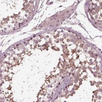 Anti-VWA5B1 antibody produced in rabbit 