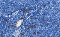 Anti-vWF Antibody, clone 1B21, ZooMAb Rabbit Monoclonal 