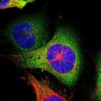 Anti-WARS antibody produced in rabbit HPA005573-100UL