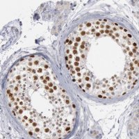 Anti-WDHD1 antibody produced in rabbit 