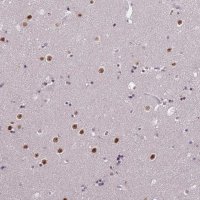 Anti-WDR18 antibody produced in rabbit HPA050193-100UL
