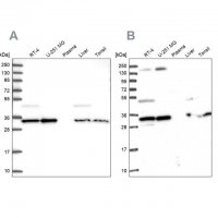 Anti-WDR61 antibody produced in rabbit 