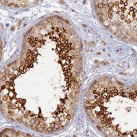 Anti-WDR62 antibody produced in rabbit 