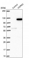 Anti-WDR63 antibody produced in rabbit 