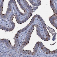 Anti-WDR66 antibody produced in rabbit 