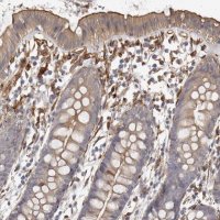 Anti-WDTC1 antibody produced in rabbit HPA028182-100UL