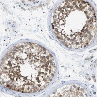 Anti-WIPI2 antibody produced in rabbit 
