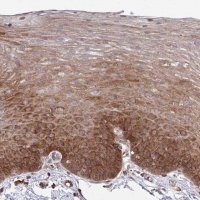 Anti-WNK1 antibody produced in rabbit 