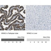 Anti-WNK2 antibody produced in rabbit 