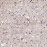 Anti-WNT10B antibody produced in rabbit 