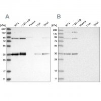 Anti-WRNIP1 antibody produced in rabbit 