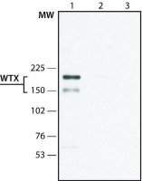 Anti-WTX (C-terminal) antibody produced in rabbit 