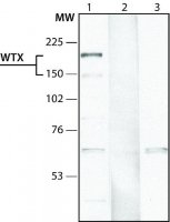 Anti-WTX (N-terminal) antibody produced in rabbit 