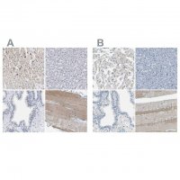 Anti-XIRP1 antibody produced in rabbit 