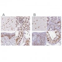 Anti-XRCC6 antibody produced in rabbit 