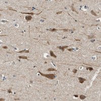 Anti-YAE1D1 antibody produced in rabbit 