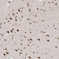 Anti-YAF2 antibody produced in rabbit 